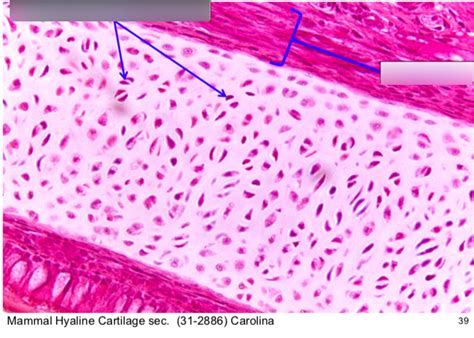 Hyaline cartilage Diagram | Quizlet