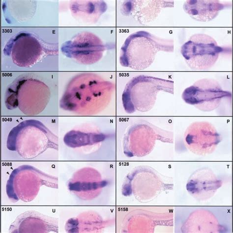(PDF) A gene expression screen in zebrafish embryogenesis 