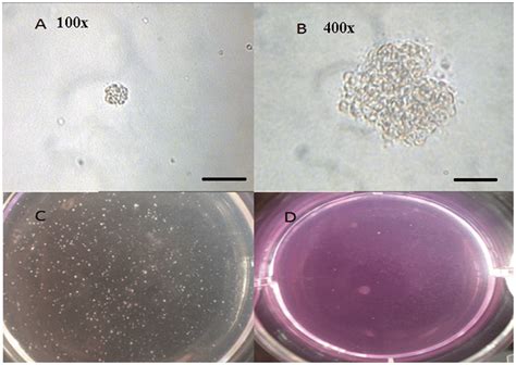 Representatives Of Colony In Soft Agar A A Colony In Soft Agar Download Scientific Diagram