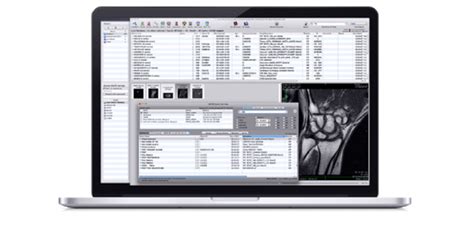 OsiriX DICOM Viewer | OsiriX MD