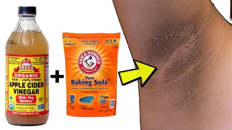 Apple Cider Vinegar And Baking Soda For Dark Underarms Youtube