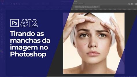 Como Tirar Manchas Da Imagem No Photoshop YouTube