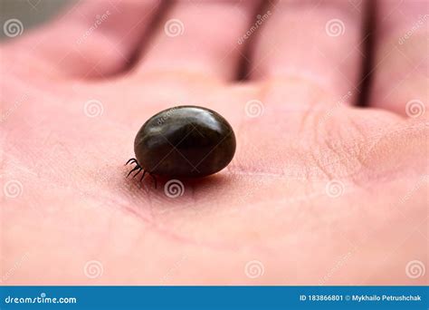 Tick Maximum Filled With Blood Sitting On Human Skin Stock Image