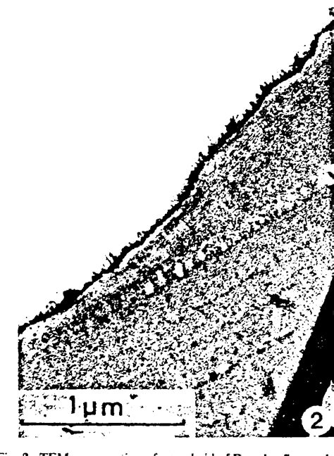 Figure 2 From Transmission Electron Microscopy And X Ray Microanalysis Of Potassium Permanganate