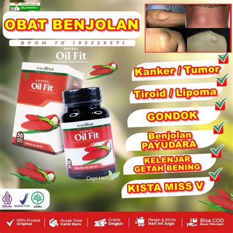 Jual KAPSUL OILFIT Benjolan Leher GONDOK Lipoma Uci Uci Kelenjar Getah