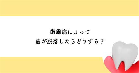 【武蔵小金井の歯医者】歯周病によって歯が脱落したらどうする 武蔵小金井の歯医者｜武蔵小金井駅前歯医者