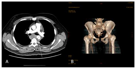 Medicina Free Full Text A Rare And Easily Overlooked Case Of