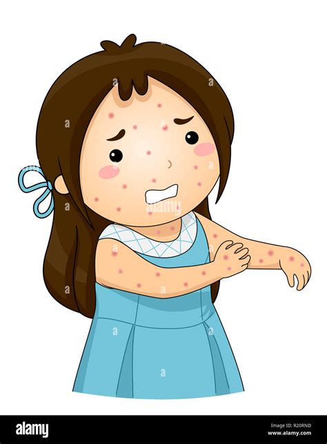 Itchy Skin Clipart