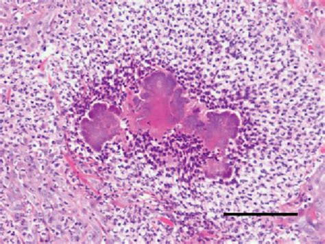 Figure 1 from Bacterial Pseudomycetoma (Botryomycosis) in an FIV-positive Cat FIV陽性猫にみられた細菌性偽菌腫 ...