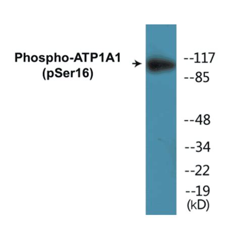 Atp1a1 Phospho Ser16 Cell Based Elisa Kit A102142