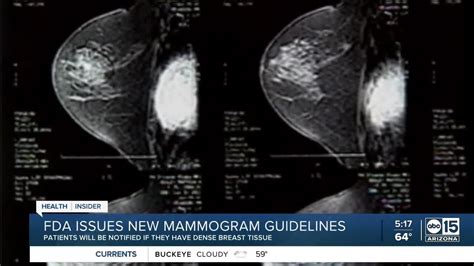 Fda Issues New Mammogram Guidelines Youtube