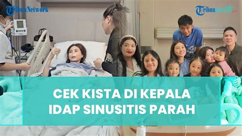 Awal Mula Sarwendah Didiagnosis Idap Sinusitis Parah Hingga Operasi