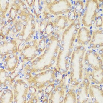 High Affinity And Specificity KO Validated TOM20 Polyclonal Antibody