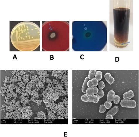 Alcaligenes Faecalis Colony Morphology