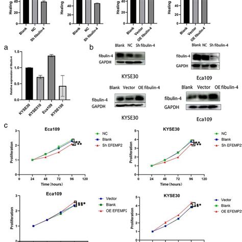 Expression Of Fibulin In Esophageal Squamous Cell Carcinoma Escc