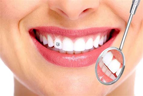 Why Should I Get Teeth Jewellery Blue Tooth Dental