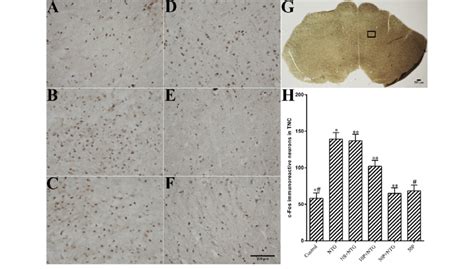 Pregabalin Pretreatment Reduced The Number Of C Fos Immunoreactive