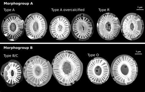 Examples Of Identified Emiliania Huxleyi Morphotypes In This Study The