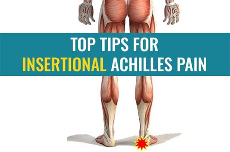 Top Tips For Insertional Achilles Tendinopathytendonitis Treat My Achilles