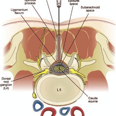 Posterior-anterior view of the cervical spine during C7/T1 ...