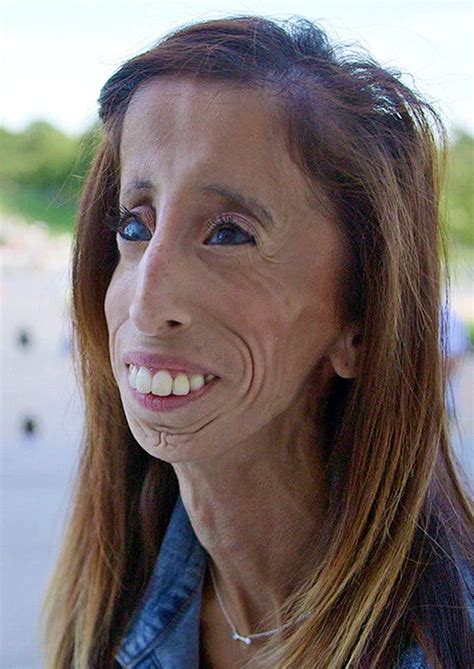 Review ‘a Brave Heart The Lizzie Velasquez Story ’ One Woman’s Push For Acceptance The New