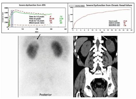 Essentials Of Nuclear Medicine Imaging Th Edition Images Poster