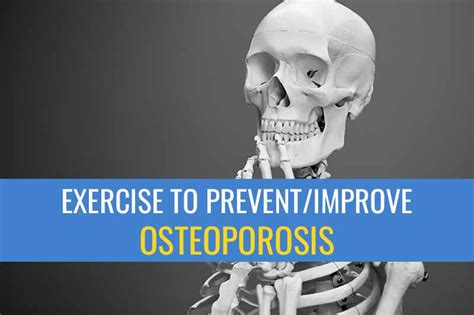 Exercise To Prevent Andor Improve Osteoporosis Sports Injury Physio