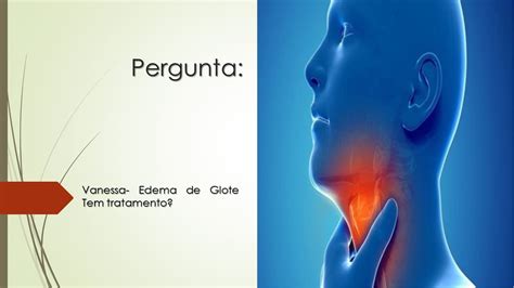 O Que E Edema De Glote - Edema de Glote Tem tratamento? - YouTube