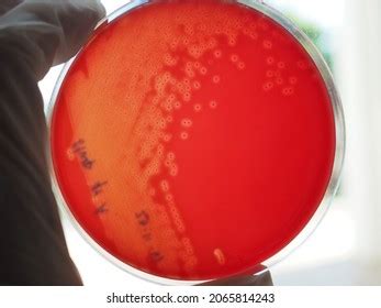 Characteristics Betahemolysis On Blood Agar Plate Stock Photo