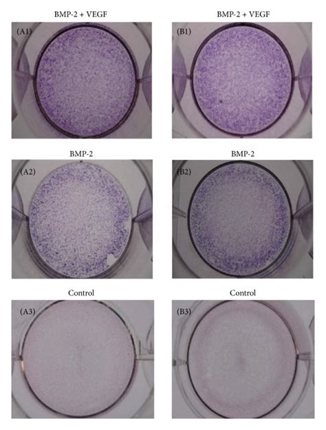 Assessment Of Potentiated Osteoinductivity A Measurement Of Cytokine