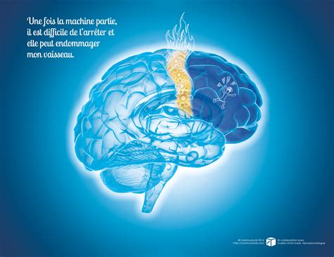 Mon cerveau et l impulsivité Aider l enfant impulsif à comprendre