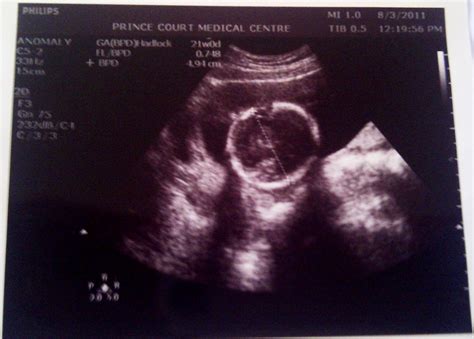 The pEtiTe CrOwN: All the pictures from baby 3D Scan (^_^)