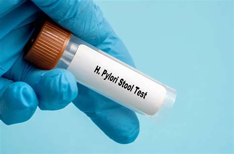 Tes H Pylori Stool Antigen Tujuan Manfaat Dan Prosedur Halodoc