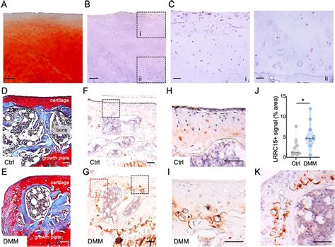 Lrrc Immunostaining In Human And Mouse Oa Cartilage Representative