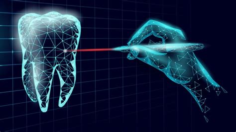 Endodoncia Digital Guiada El Auge De La Odontolog A De Precisi N