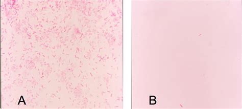 Pseudomonas Gram Stain Morphology