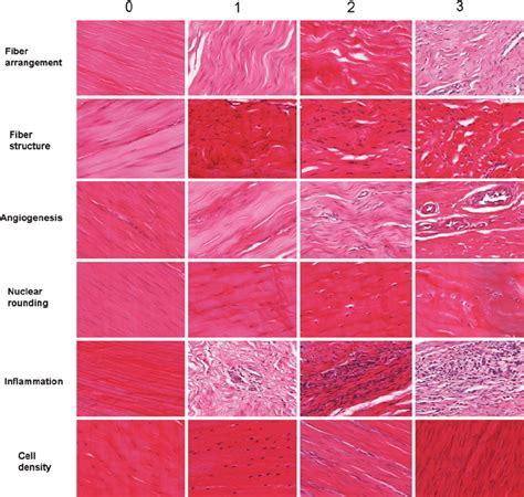 HE 40 Semi Quantitative Histology Scoring System 0 Normal 1