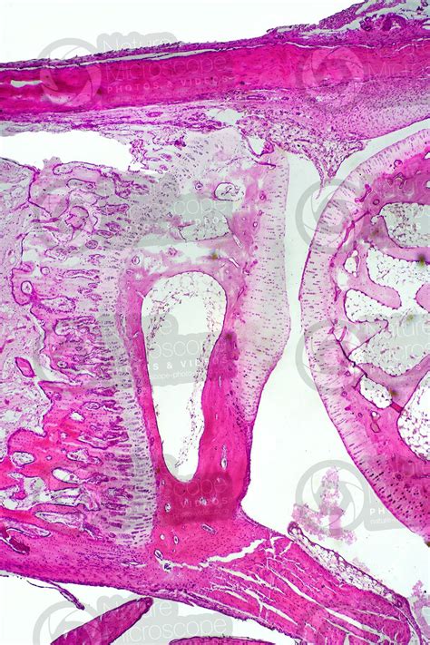 Mammal Joint Longitudinal Section 32X Spongy Osseous Tissue