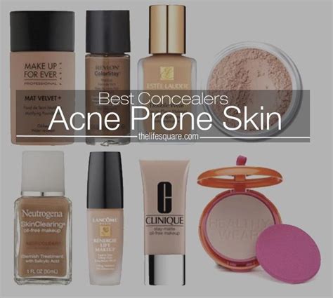 Best Concealers For Acne Prone Skin To Cover All Your Imperfections