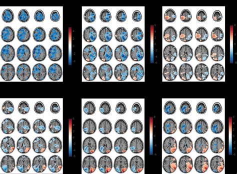 Figure S Spectral Power Differences In The Post Cue Window Between