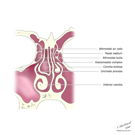 Concha Bullosa Do You Suffer From Persistent Nose Block