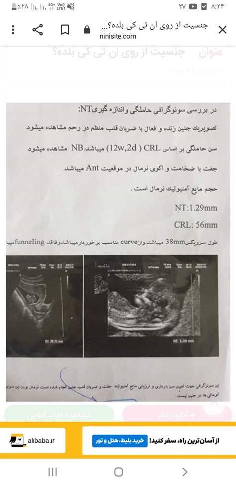 عکس ان تی و جنسیت بیاید مامانا بیاید تبادل نظر نی نی سایت