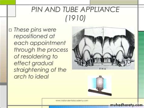 Fixed Orthodontic Appliances Pptx Drhakam Muhadharaty