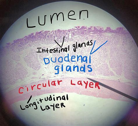 Duodenum Histology.