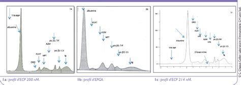 Figure 1 from Lélectrophorèse des protéines sériques en biologie