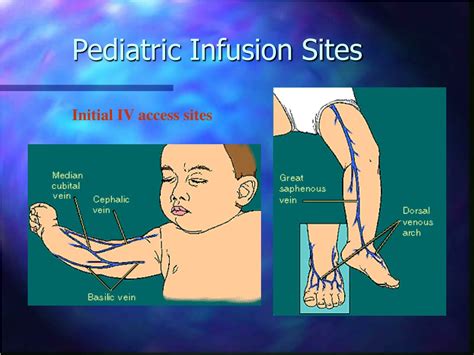 PPT - ALS & EMT-IV IV-IO Proficiency: Intravenous & Intraosseous ...