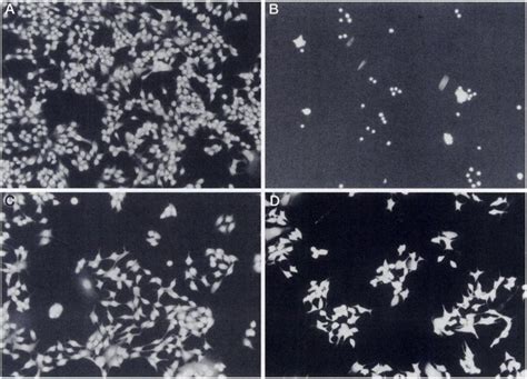 Visualization Of Apoptolic Responses Of Mcf 7 Cells After ÃŸ Lap Or Crt Download Scientific