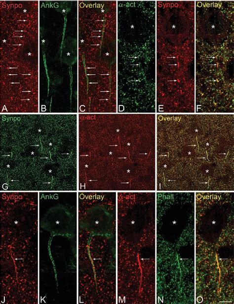 Figure From Colocalization Of Actinin And Synaptopodin In The