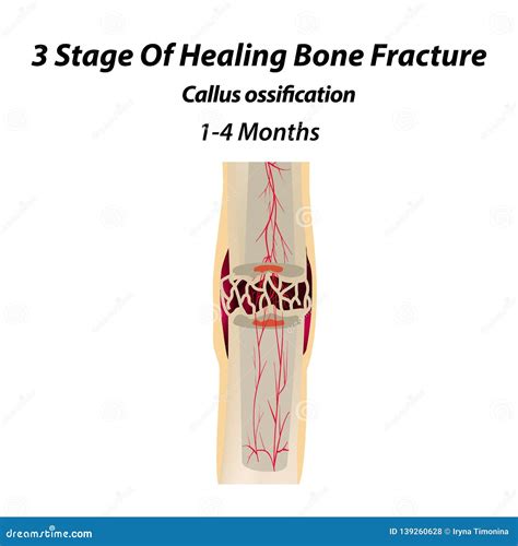 Bone Remodeling