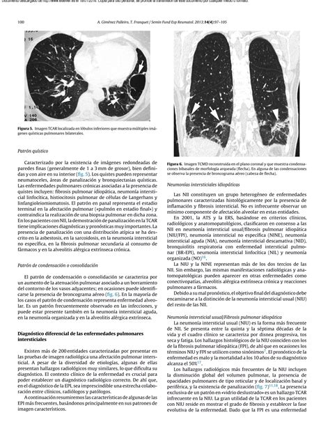 Patrones Radiologicos En La Enfermedad Pulmonar Intersticial Pdf